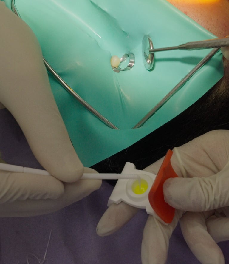 ADESIVO IN CONSERVATIVA (OTTURAZIONE) (2)