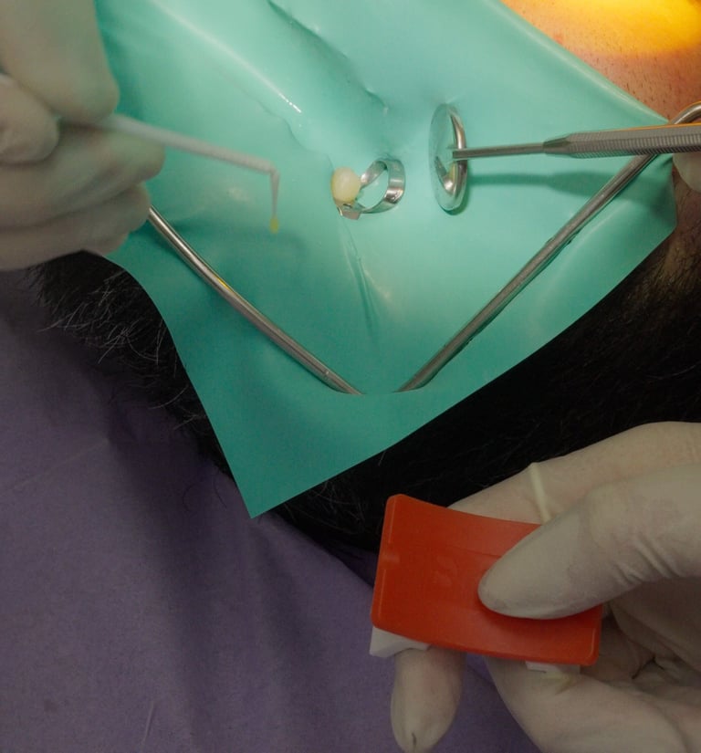 ADESIVO IN CONSERVATIVA (OTTURAZIONE)