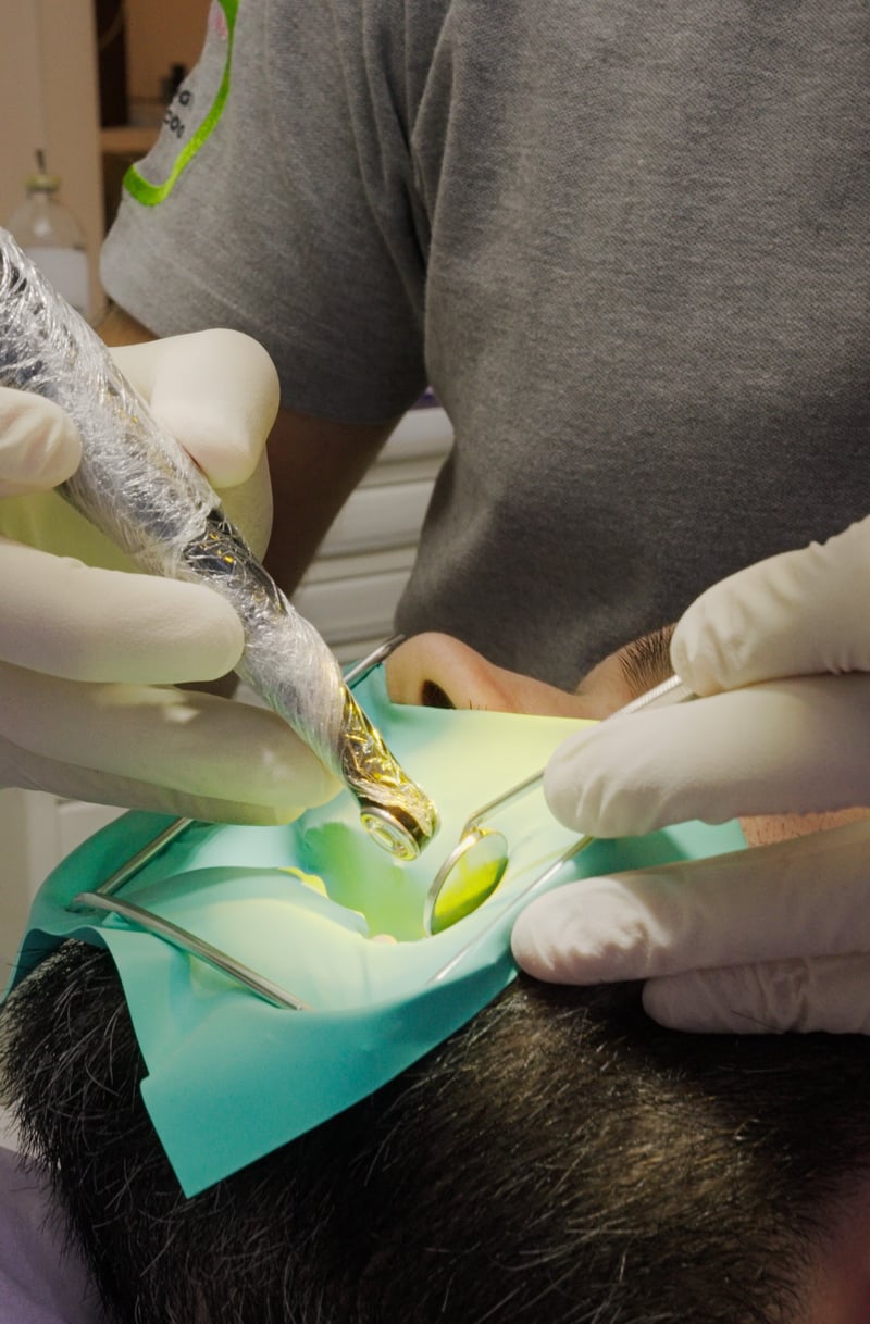 FISSAGGIO DEL COMPOSITO CON LAMPADA POLIMERIZZATRICE (OTTURAZIONE) CONSERVATIVA