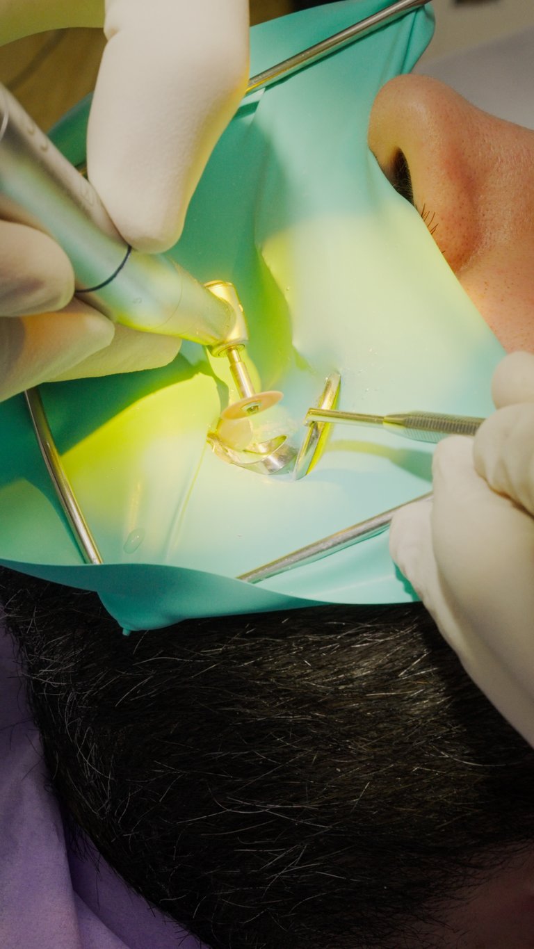 LUCIDATURA CON DISCHETTO CONSERVATIVA (OTTURAZIONE)