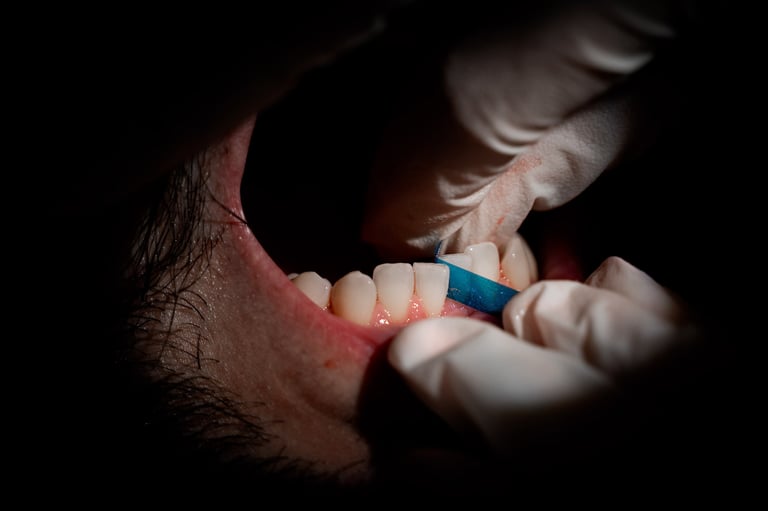 lucidatura-igiene-dentale-3