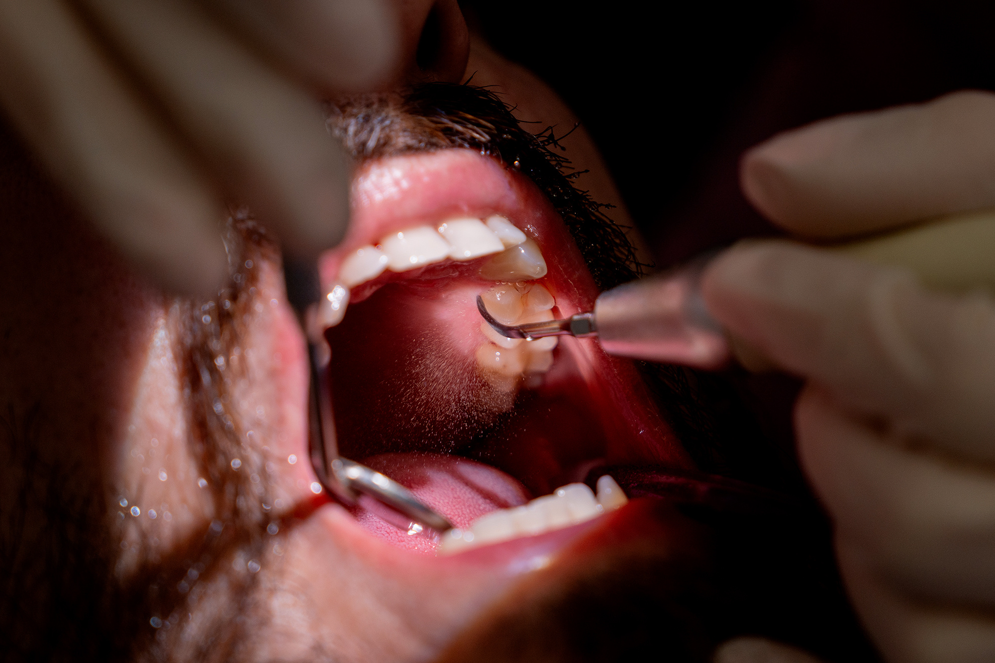 primo-piano-igiene-dentale